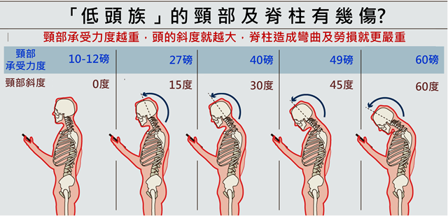 低頭族頸椎傷害