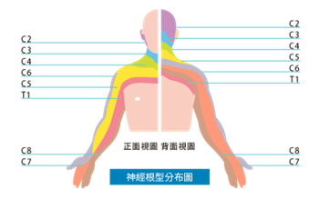 神經根壓分布圖