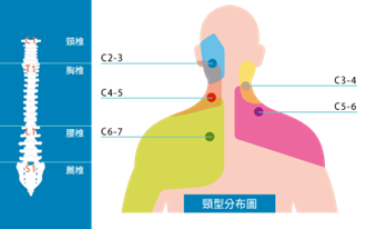 頸壓分佈圖