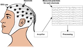 腦電圖(EEG)記錄腦部電波活動
