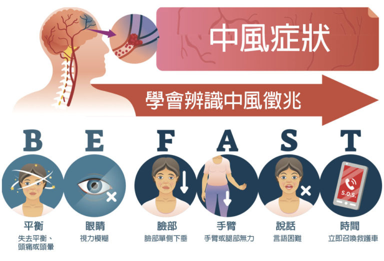 中風症狀