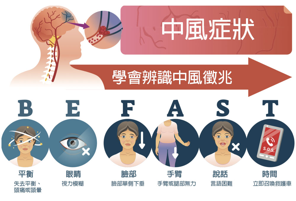 中風全面指南:教育、篩查、預防、24小時MRI及急性中風護理 – 香港微創腦及脊椎神經外科手術中心